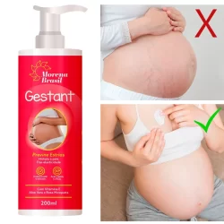 Creme Prevenção de Estrias – Segurança e Hidratação para Mamães
